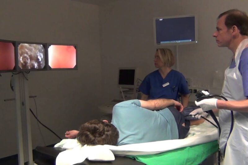 Faktoren für die Wahl einer Darmspiegelung